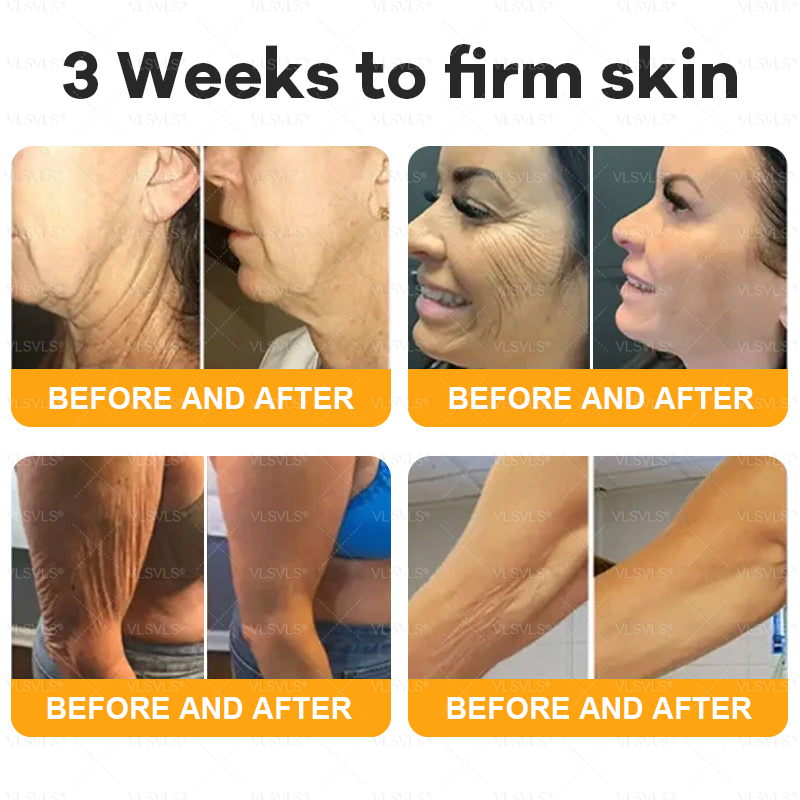 VLSVLSÂŽ  đOnly 5 boxes left! We're offering you an additional 30% discount! Get yourself in shape and healthy. Miss out now, and you won't have another chance until next year.