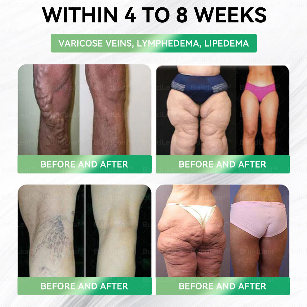 𝑩𝒖𝐢𝒍𝒅𝑳𝒆𝐚𝒇®🎁Only 5 boxes left! We're offering you an additional 30% discount! Get yourself in shape and healthy. Miss out now, and you won't have another chance until next year.